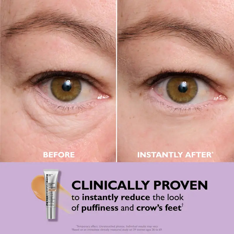 BlinkBoom™️ Eye Bag Tightening Cream